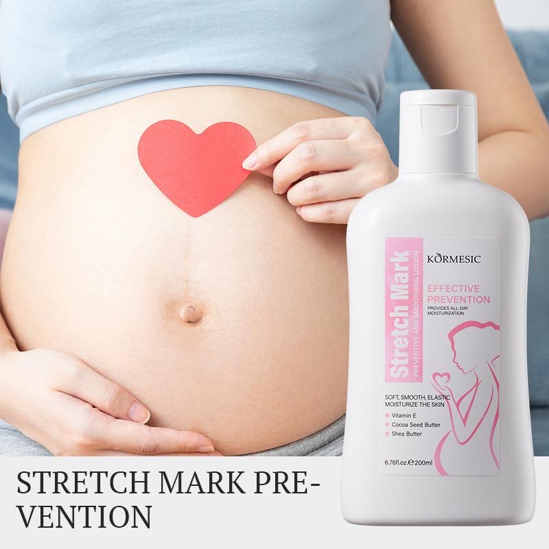 Stretch marks preventing - Image 2
